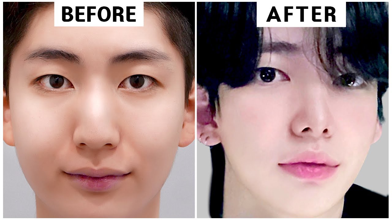 In Korea, Get Handsome with Just a Nose Job!!