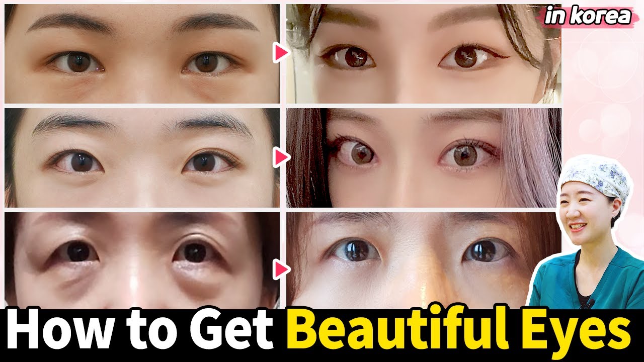 Top 3 Procedures That Work Best with Eye Surgery!