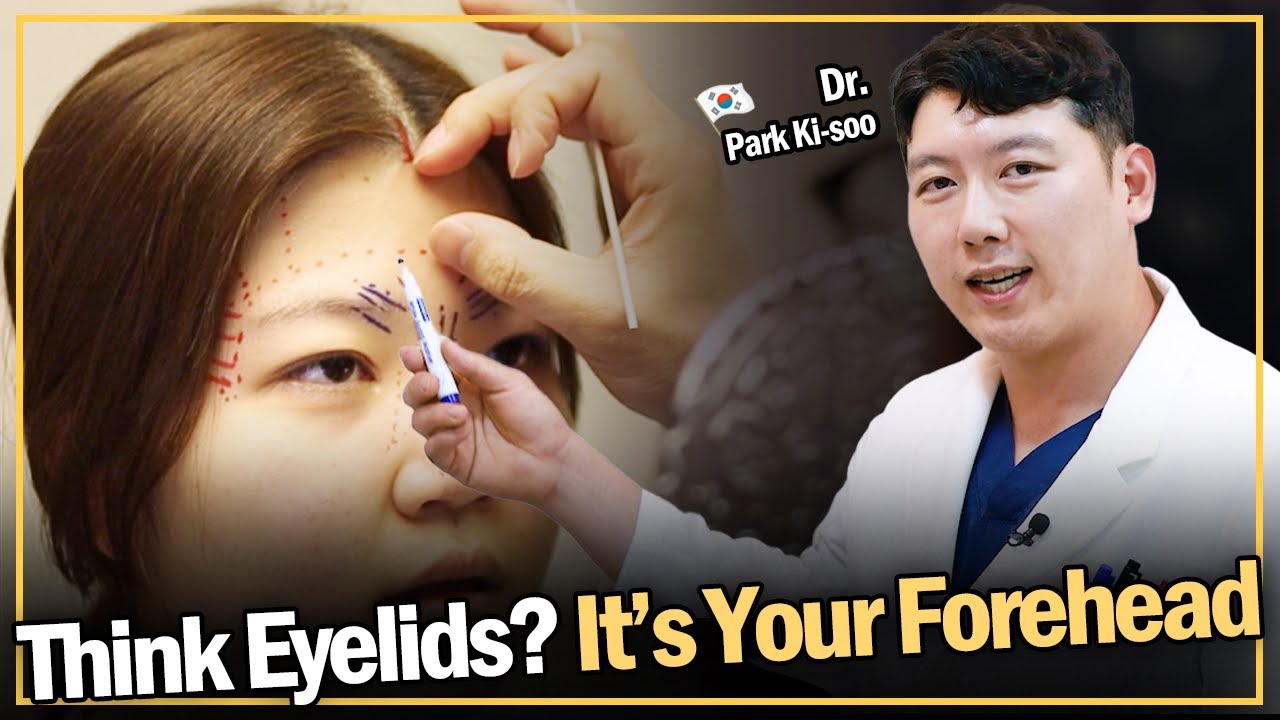 For Droopy Eyelids and Forehead Wrinkles? Endoscopic Forehead Lift! One Video to End Your Worries!